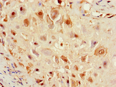 CSB-PA007932LA01HU