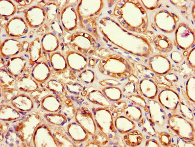 CSB-PA007932LA01HU