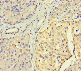 CSB-PA896756LA01HU