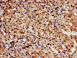 CSB-PA023218LA01HU