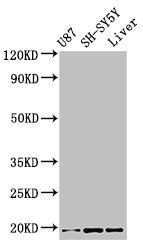 CSB-PA025141LA01HU
