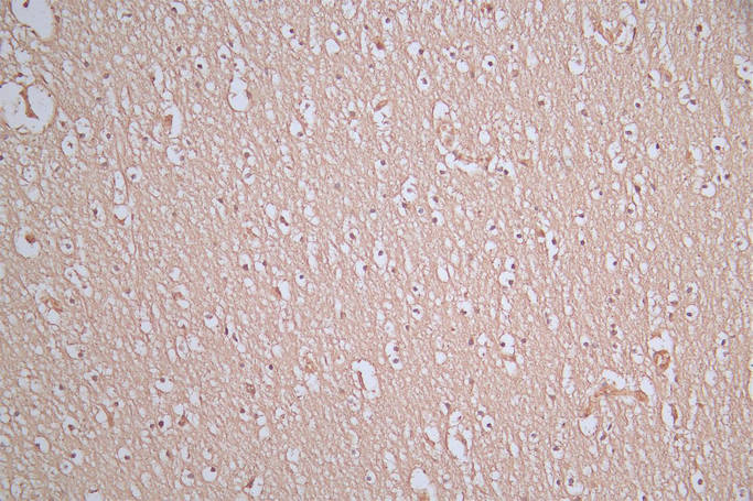 CSB-RA024077MA1HU IHC