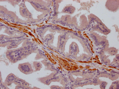 CSB-RA186773A0HU