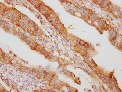 CSB-RA932542A0HU