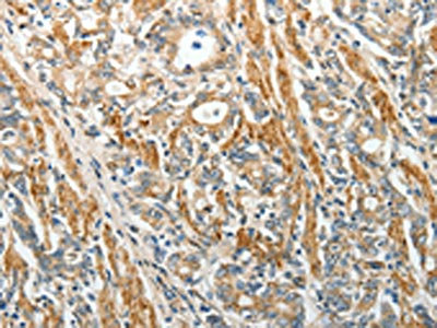 CSB-PA056380