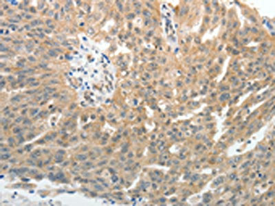 CSB-PA056380