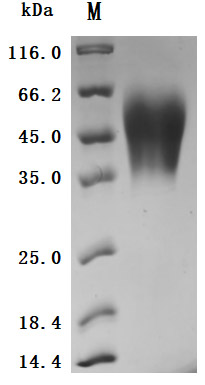 CSB-MP005166HU-SDS