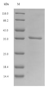 CSB-EP851843MO SDS-PAGE